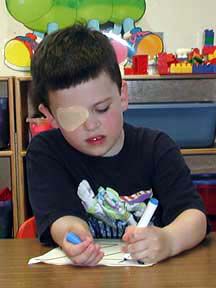 Child With Amblyopia