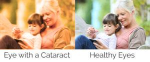cataract-symptom