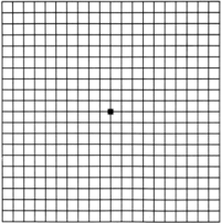 Amsler Grid