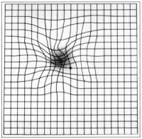 Amsler Grid